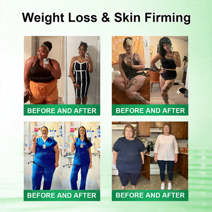𝐈𝐧𝐬𝐋𝐞𝐦𝐨𝐧® 𝗠𝗼𝗿𝗶𝗻𝗴𝗮 × 𝗕𝗲𝗿𝗯𝗲𝗿𝗶𝗻𝗲 × 𝗔𝗠𝗣𝗞 𝟭𝟬-𝗶𝗻-𝟭 𝗠𝗲𝘁𝗮𝗯𝗼𝗹𝗶𝗰 𝗦𝘂𝗽𝗽𝗼𝗿𝘁 𝗡𝗮𝗻𝗼 𝗠𝗶𝗰𝗿𝗼𝗻𝗲𝗲𝗱𝗹𝗲 𝗣𝗮𝘁𝗰𝗵🇬🇧(𝐉𝐮𝐬𝐭 𝐨𝐧𝐜𝐞 𝐚 𝐝𝐚𝐲, 𝐯𝐢𝐬𝐢𝐛𝐥𝐞 𝐜𝐡𝐚𝐧𝐠𝐞𝐬 𝐢𝐧 𝟕 𝐝𝐚𝐲𝐬） ✅ 𝐅𝐨𝐫 𝐨𝐛𝐞𝐬𝐢𝐭𝐲, 🅛🅞🅞🅢🅔 🅢🅚🅘🅝, 𝐝𝐢𝐚𝐛𝐞𝐭𝐞𝐬, 𝐬𝐥𝐞𝐞𝐩 𝐚𝐩𝐧𝐞𝐚, 𝐣𝐨𝐢𝐧𝐭 𝐢𝐬𝐬𝐮𝐞𝐬, 𝐚𝐧𝐝 𝐦𝐨𝐫𝐞⭐⭐